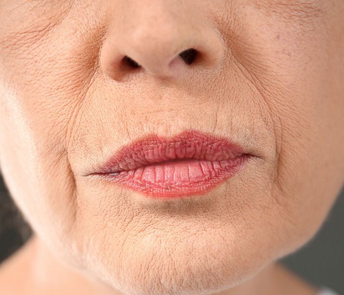 O envelhecimento da pele está diretamente relacionado ao ato de fumar