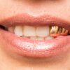 Dentes de ouro: saiba os riscos do acessório para a saúde bucal