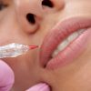 Micropigmentação labial: profissional explica detalhes sobre a técnica