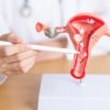 Câncer de ovário: conheça os riscos e os sintomas da doença